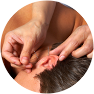 Acupuncture Brisbane and Sunshine Coast